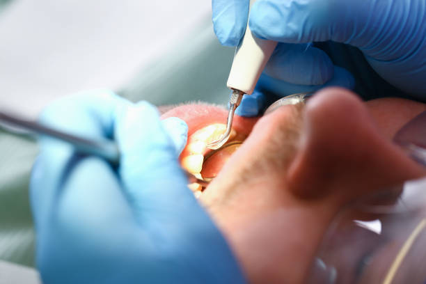 Best Dentist Open Late Near Me  in Catahou, LA