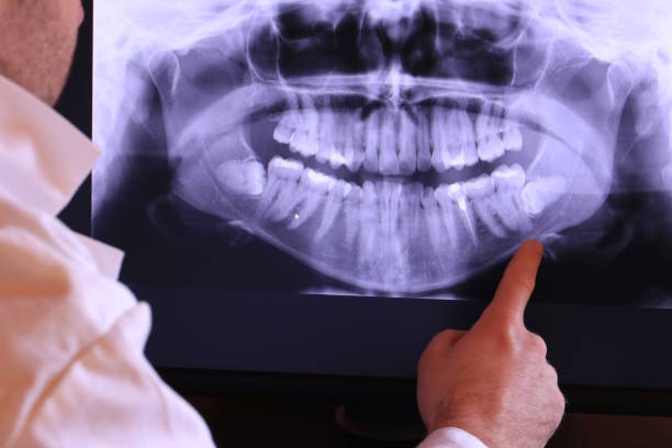 Best Knocked-Out Tooth Emergency  in Catahou, LA